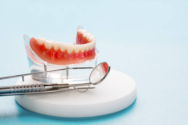 Full Mouth Reconstruction in San Miguel, CA